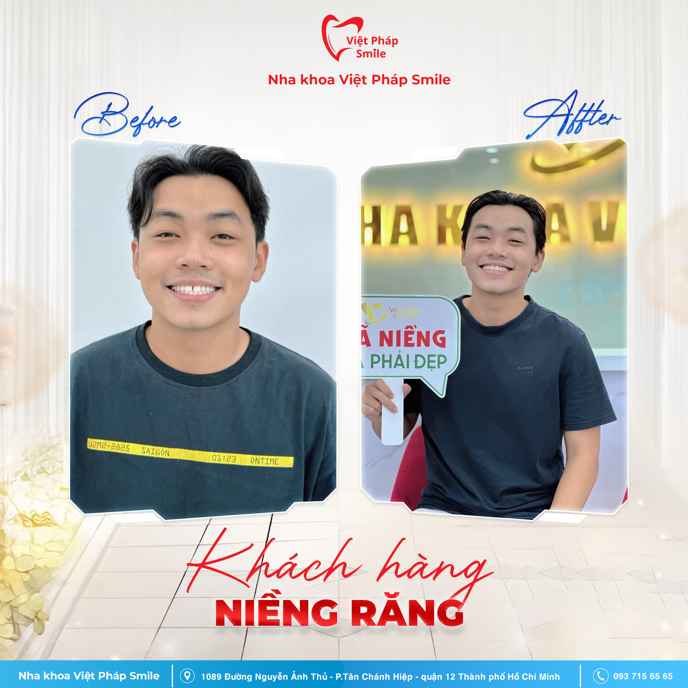 BA nieng rang 2
