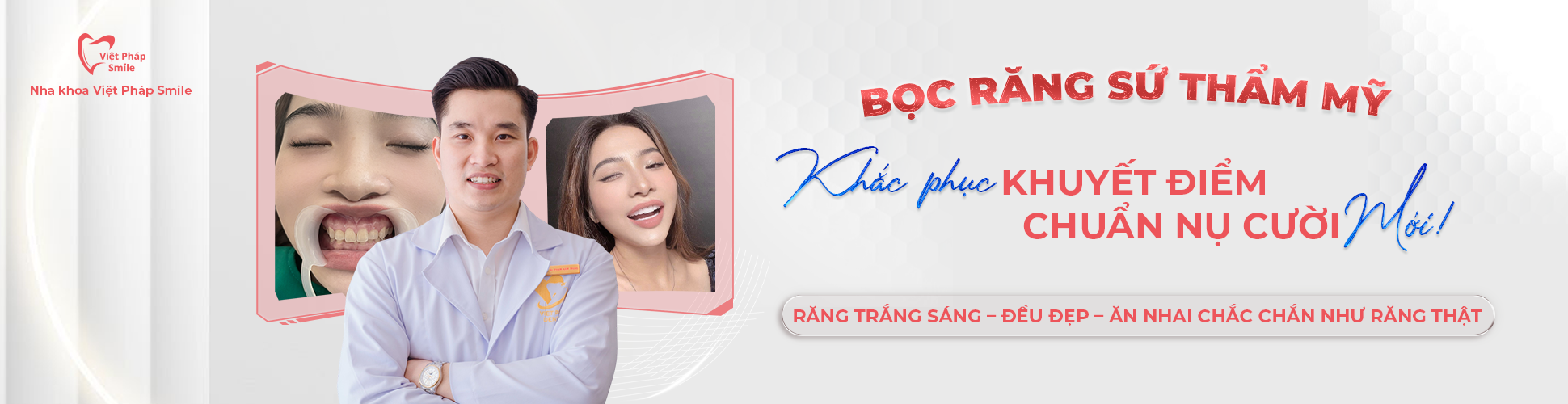 BỌC RĂNG SỨ THẨM MỸ