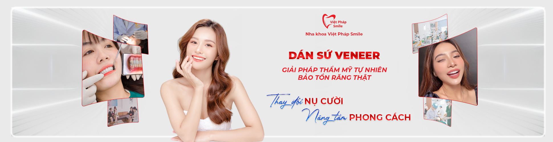 Dán sứ Veneer