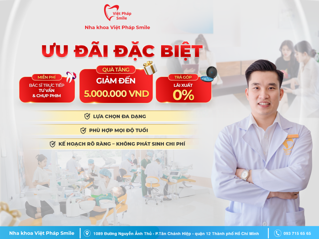 ke-hoach-nieng-rang-tai-viet-phap-smile