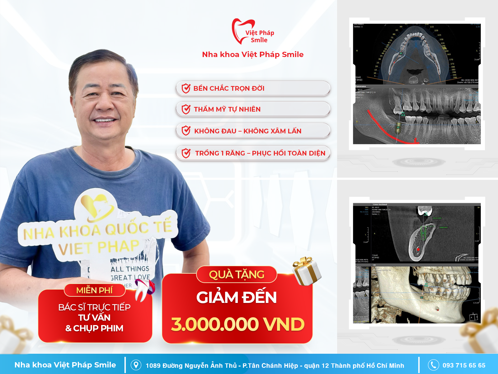 Trồng răng Implant