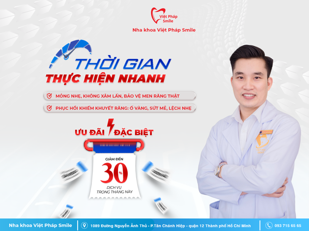 Thời gian thực hiện nhanh