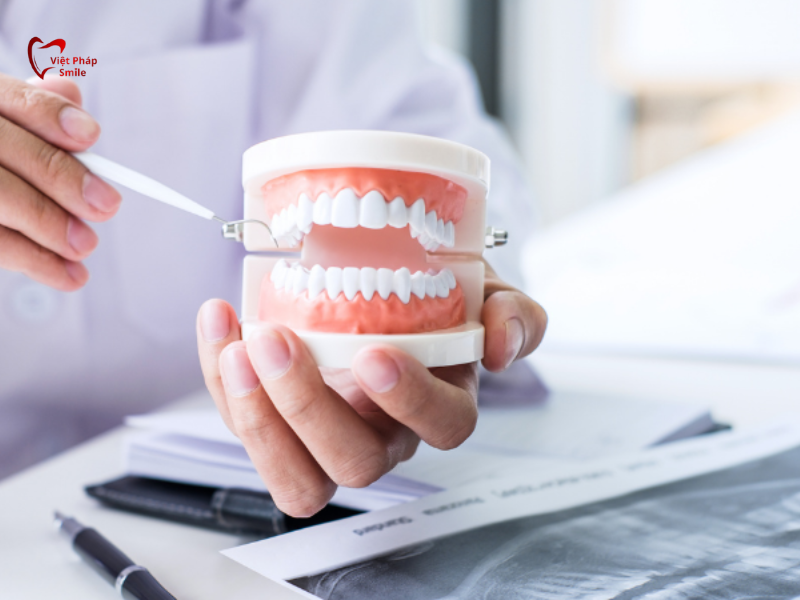 Ưu và nhược điểm của hàm tháo lắp so với cầu răng và implant