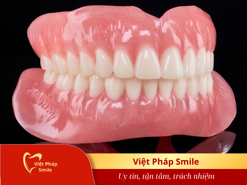 hàm giả toàn phần
